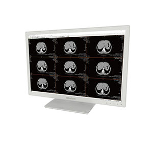 monitor de alta definición