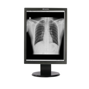 monitor de diagnóstico