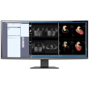 monitor de alta definición