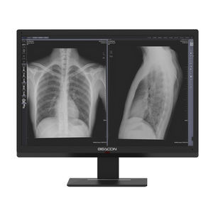 monitor de alta definición