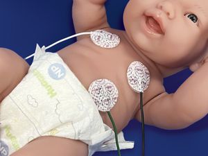 electrodo ECG