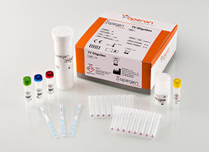prueba rápida de tricomoniasis / de Trichomonas vaginalis / para ADN / inmunocromatográfica