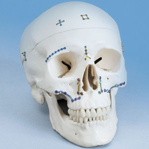 placa de compresión para macizo facial 1
