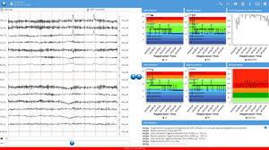 software de visualización / de análisis / para EEG / para electrofisiología