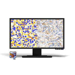 módulo de software para inmunohistoquímica