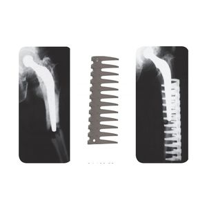 placa de compresión para fractura femoral periprotésica 1