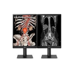 monitor de diagnóstico 1