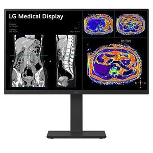 monitor médico 1