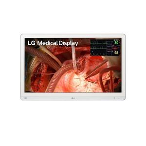 monitor para endoscopia 1