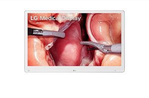 monitor para endoscopia 1