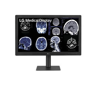 monitor médico 1