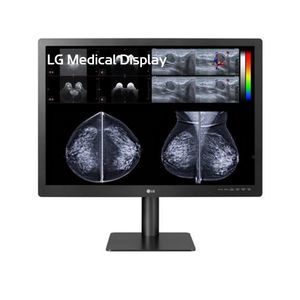 monitor de diagnóstico 1