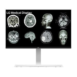 monitor médico 1