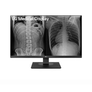 monitor médico 1
