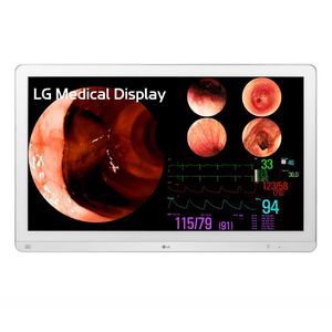monitor para endoscopia 1