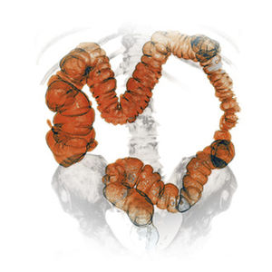 módulo de software de oncología