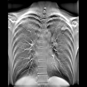 software para imágenes médicas