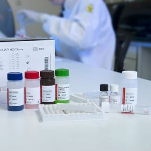 kit de prueba de hepatitis C / VHC / de suero / por plasma