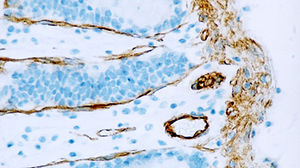reactivo anticuerpo monoclonal 1