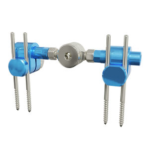 fijador externo para articulación metacarpofalángica 1