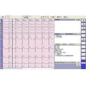 software para electrocardiografía
