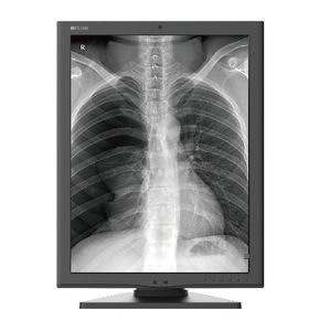 monitor de diagnóstico