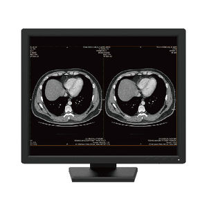 monitor de diagnóstico