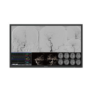 monitor para quirófano