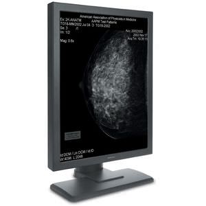monitor mamográfico