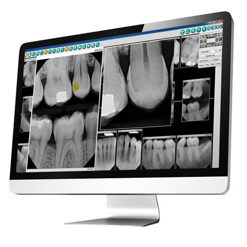 Software para odontología - DEXIS - de adquisición / de planificación de tratamiento / de importación