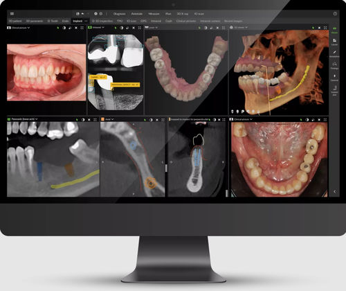 Software clínico - DTX™ Studio - DEXIS - para odontología / para imagen dental / de gestión