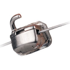 Tubo bucal molares - SnapLink™ - Ormco - convertible