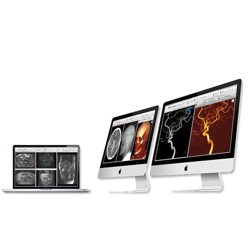 Software de postprocesamiento - aycan Medical Systems - de visualización 3D / de diagnóstico / de evaluación