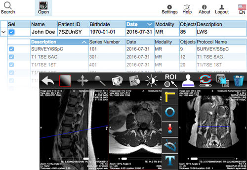 Aplicación web de intercambio - aycan Medical Systems - de visualización DICOM / para imágenes médicas / procesos basados en la web
