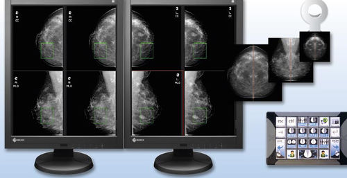 Módulo de software de visualización - aycan Medical Systems - de gestión de datos / para mamografía