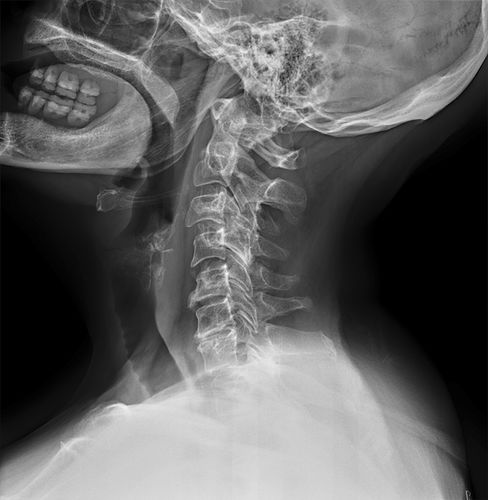 Software de radiografía - Altumira™  - ContextVision - de angiografía / de mejora de la imagen