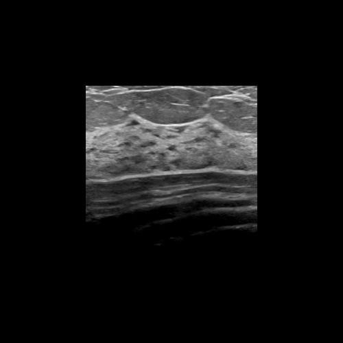 Software de mejora de la imagen - Rivent™  - ContextVision - clínico / para ecografía / cardiovascular