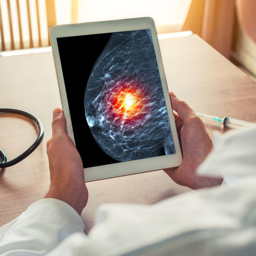 Algoritmo de diagnóstico - SecondLook® - iCAD - de análisis / de tratamiento / para detección del cáncer de mama