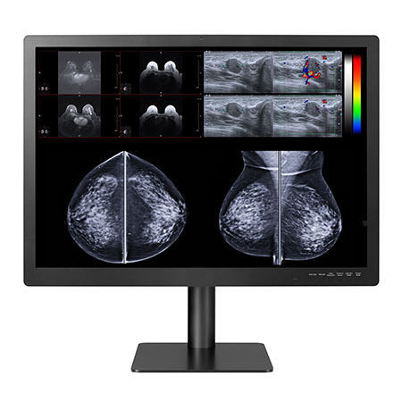 Monitor médico - GEMINI-12MP - Double Black Imaging - de diagnóstico / 31" / LCD