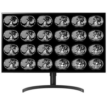 Monitor médico - CL8MPS32C - Double Black Imaging - de diagnóstico / 3.840x 2.160 / 32"