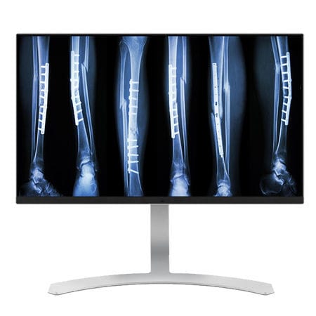 Monitor médico - CL8MPS - Double Black Imaging - de diagnóstico / 3.840x 2.160 / 27"