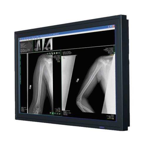 Monitor médico - FP4204B - Double Black Imaging - para sala de operaciones / para endoscopia / quirúrgico