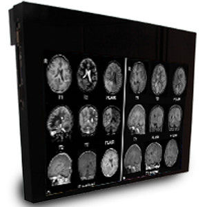 Monitor médico - DBI24 - Double Black Imaging - 1920x1200 / 24" / LCD