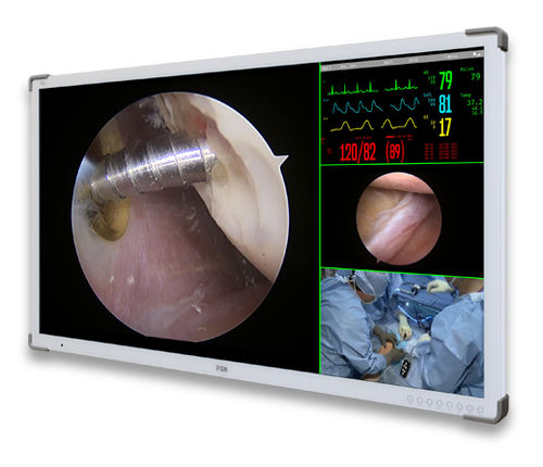 Monitor médico - C55SF - Double Black Imaging - quirúrgico / Full HD / 3.840x 2.160