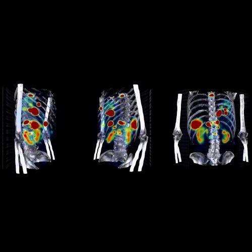 Software de diagnóstico - Theranostics - Hermes Medical Solutions, Inc - de tratamiento / médico