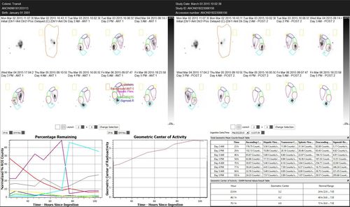Software de análisis - Hermes Medical Solutions, Inc - de gastroenterología