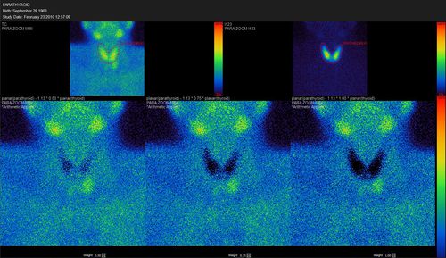 Software visualizador - Hermes Medical Solutions, Inc - para cuantificación / SPECT / sistema endocrino