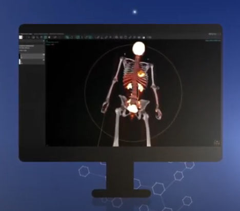 Software para informes - vendor-neutral - Hermes Medical Solutions, Inc - clínico / TDM / TEP