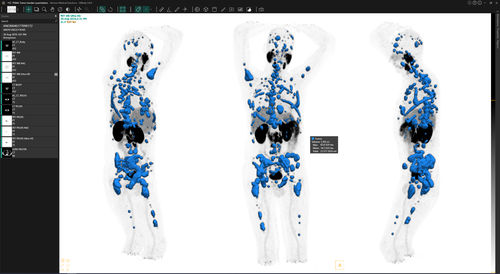 Software de tratamiento - Voxel dosimetry™ - Hermes Medical Solutions, Inc - de validación / clínico / TDM