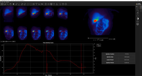 Software de análisis - Hermes Medical Solutions, Inc - médico / para cirugía / de hígado